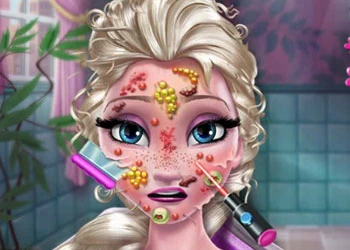 Ice Queen Skin Doctor captură de ecran a jocului
