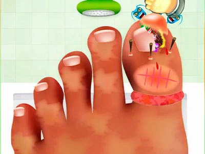 Nagelchirurgie Spel schermafbeelding van het spel